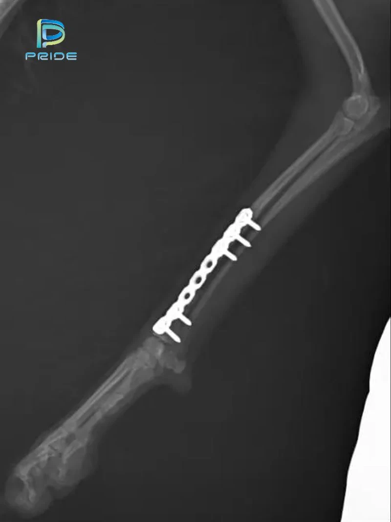 Different bones, different screws