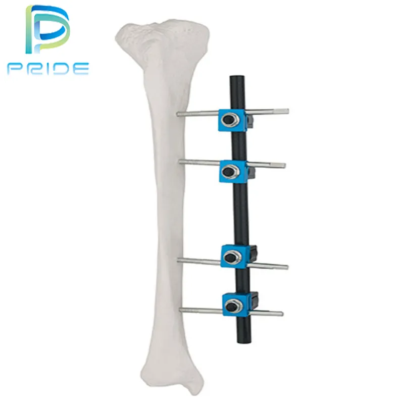 orthopedic External Fixation orthopedic External Fixation